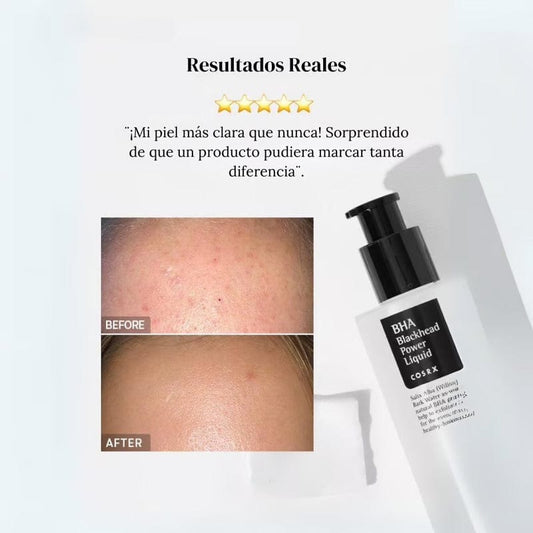 COSRX BHA Blackhead Power Liquid سائل BHA يخفي المسام والرؤوس السوداء 100ml