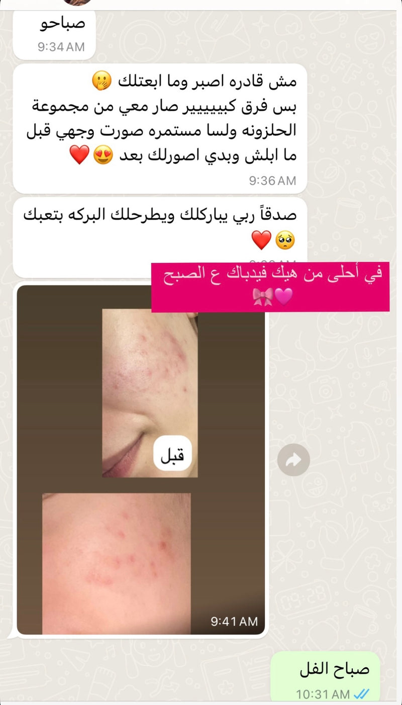 فيدباك زبونة