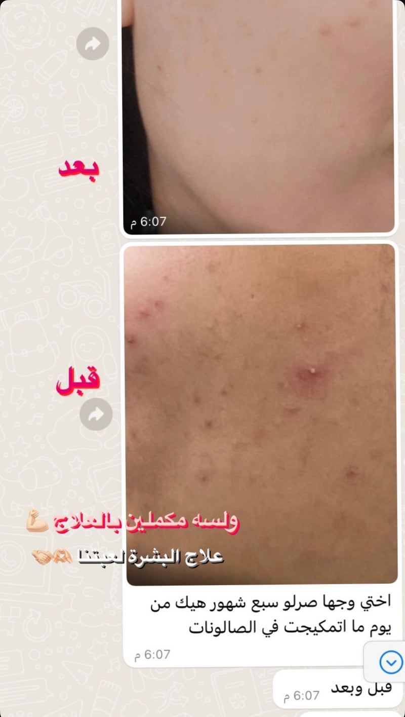 فيدباك زبونة